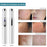 Stylo Enlèvement Acné Cicatrice Rides