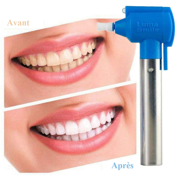 Blanchisseur de dents Fonctionne à piles - Luma Smile